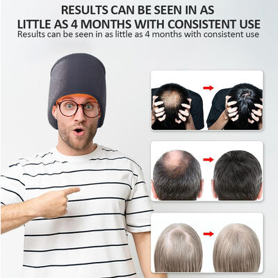 660nm Cap Hair Growth LED Therapy και 270 Led Cap Therapy με κόκκινο φως